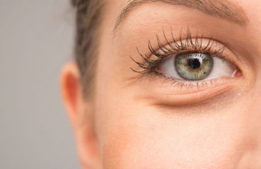 Augenlidsenkung: Warum tritt es auf und wie geht man damit um?